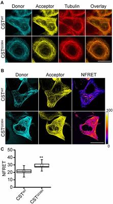 The Q336H MAPT Mutation Linked to Pick’s Disease Leads to Increased Binding of Tau to the Microtubule Network via Altered Conformational and Phosphorylation Effects